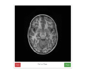 The braindr web interface: braindr is hosted at https://braindr.us. Users may click pass or fail buttons, use arrow keys, or swipe on a touchscreen device to rate the image."