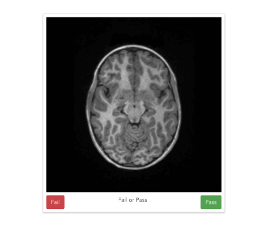 The braindr web interface: braindr is hosted at https://braindr.us. Users may click pass or fail buttons, use arrow keys, or swipe on a touchscreen device to rate the image.